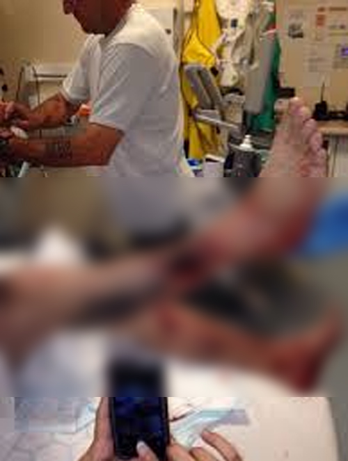 บุหรี่ไฟฟ้าระเบิด